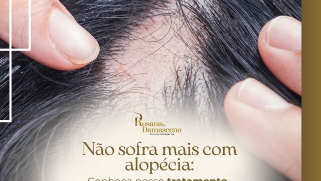 Servico-de-tratamento-para-a-queda-de-cabelo-em-Atibaia-Sao-Paulo-14
