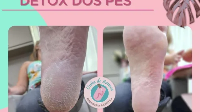 detox-dos-pes