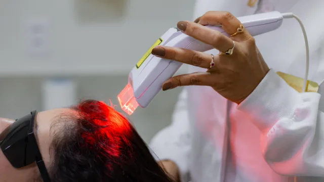 tricologista-tratamento-a-laser